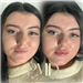 gallery thumbnail image