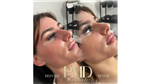 gallery thumbnail image