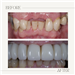 gallery thumbnail image
