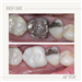 gallery thumbnail image