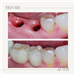 gallery thumbnail image