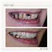 gallery thumbnail image