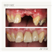 gallery thumbnail image
