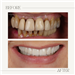 gallery thumbnail image