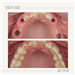 gallery thumbnail image